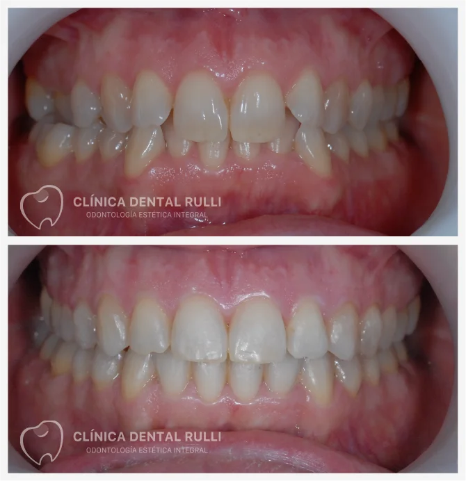 Clinica dental Rulli Casos de Éxito